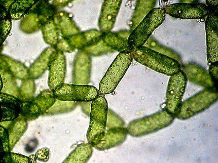 Mga kolonya ng unicellular algae sa ilalim ng mikroskopyo