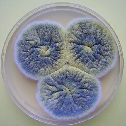 Bacteria on food